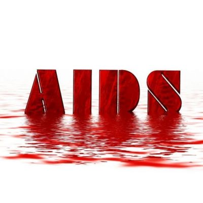 Hari Aids Sedunia 2022 Angka Penderita Tinggi, Begini Catatan Dosen UNESA
